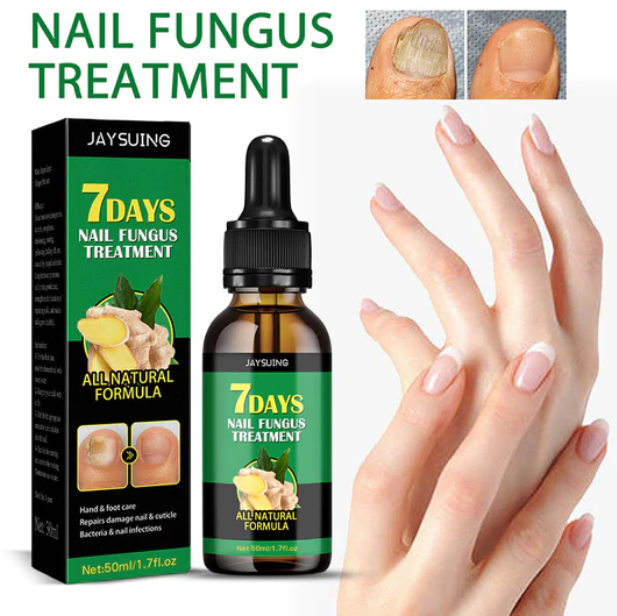 Aceite anti-hongos uñas