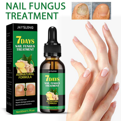 Aceite anti-hongos uñas
