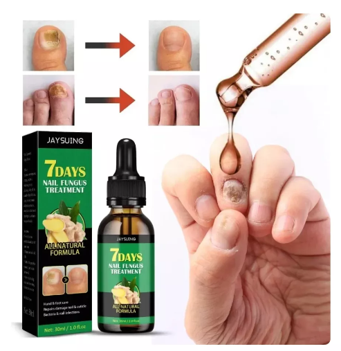 Aceite anti-hongos uñas